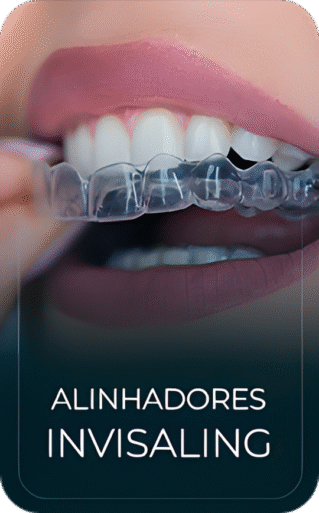 Alinhadores Invisaling_upscayl_3x_upscayl-standard-4x