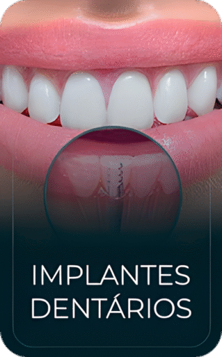 implantes dentarios_upscayl_3x_upscayl-standard-4x