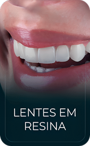 lentes em resina_upscayl_3x_upscayl-standard-4x