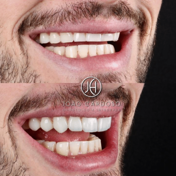 Início
