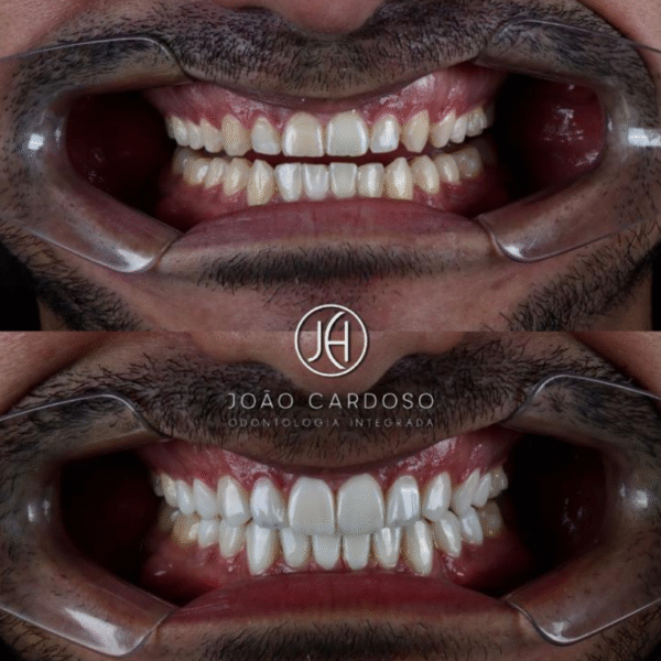 Início